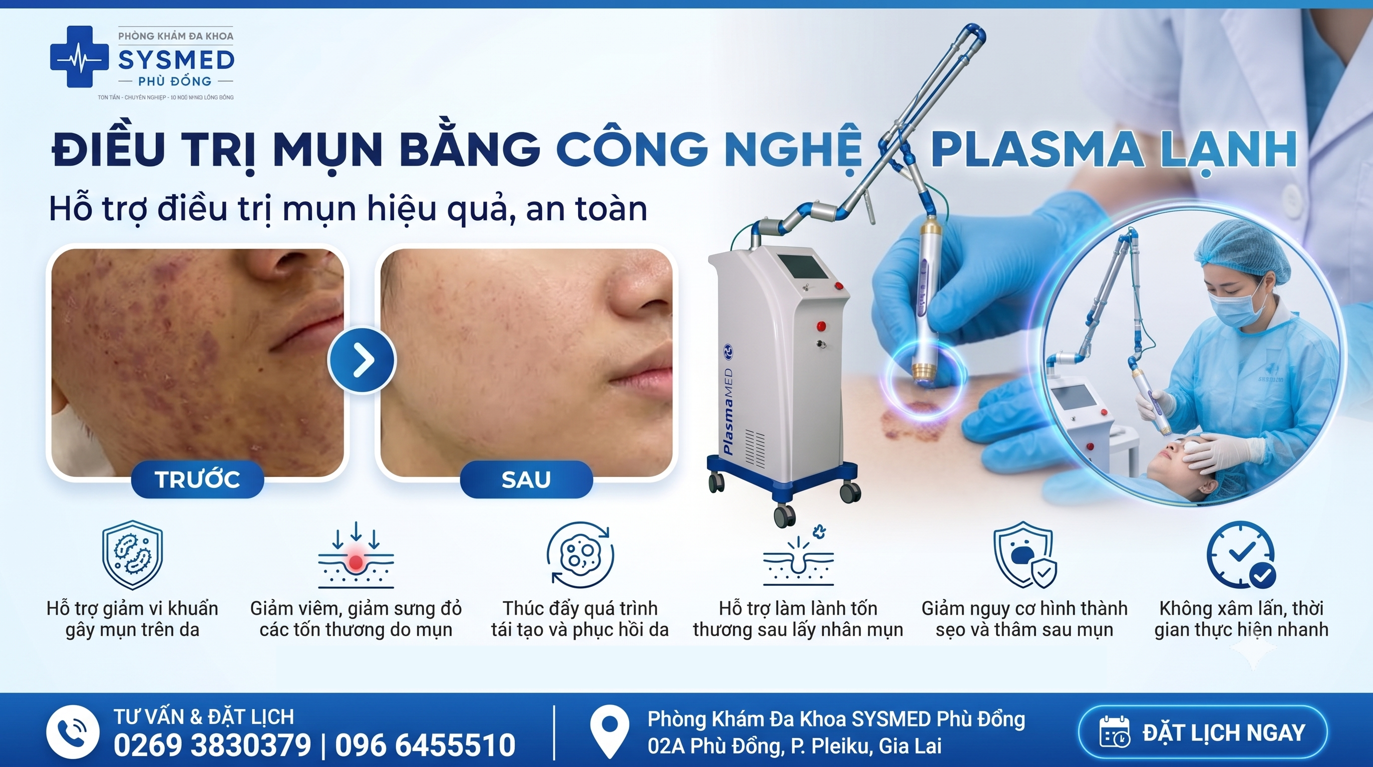 anh bia tri mun Gia Lai