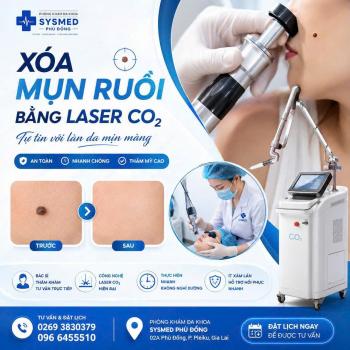 XÓA MỤN RUỒI BẰNG LASER – AN TOÀN, NHANH CHÓNG, THẨM MỸ CAO TẠI PLEIKU