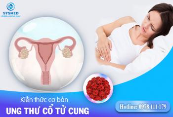 Ung thư cổ tử cung: Kiến thức cơ bản