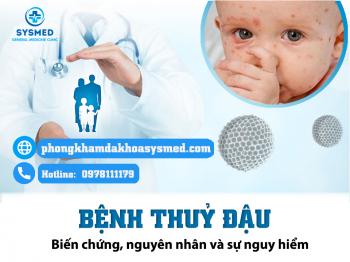 Hiểu Về Bệnh Thuỷ Đậu: Nguyên Nhân, Triệu Chứng, Biến chứng và Biện Pháp Phòng Ngừa