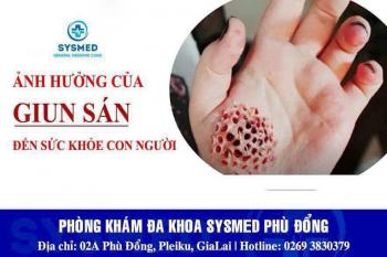 Nhiễm giun sán – Nguy cơ âm thầm, biến chứng nguy hiểm!